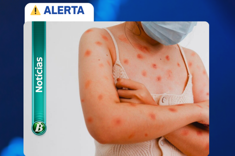 SUSPEITA DE MPOX NO RN: JOVEM É TRANSFERIDA PARA HOSPITAL DE REFERÊNCIA